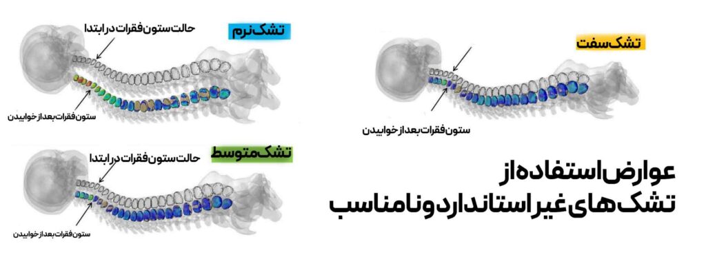 عوارض استفاده از تشک غیراستاندارد